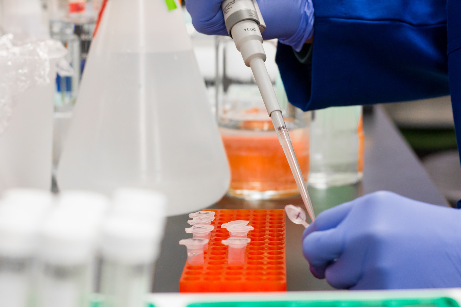 Les laboratoires de biologie médicale renouvelleront leur grève début décembre 2022